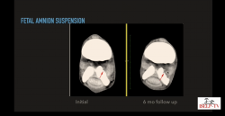 thumbnail for The Fetlock, Carpus, and Metacarpus 2024